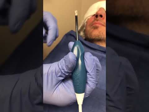 Breathing Easier Than Ever Before: The Nasopharyngeal Airway