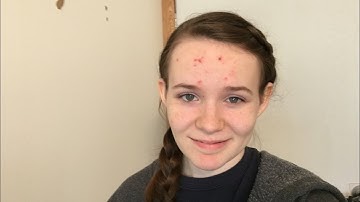 Comment Your Questions Below For A Q&A Video🙂