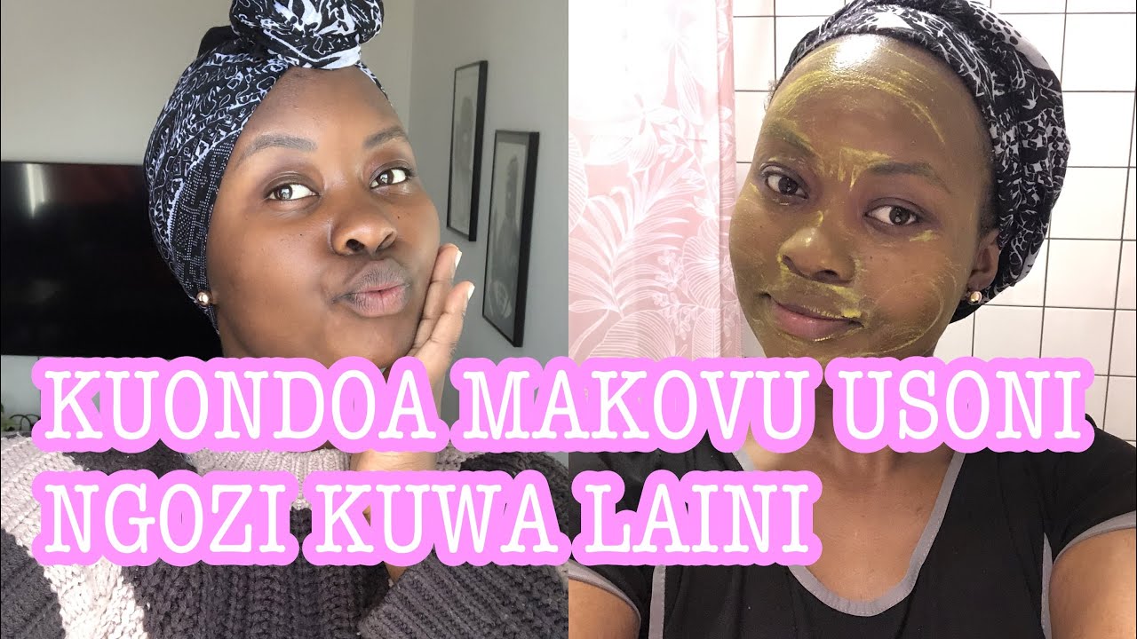 Kuondoa Chunusi Usoni Na Makovu Ya Chunusi Hata Kwa wale wenye ngozi ya