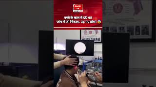 बच्चे के कान से ये क्या निकला? 😱🚨​#ChildSafety #Parenting #Alert #Shorts #ViralNews