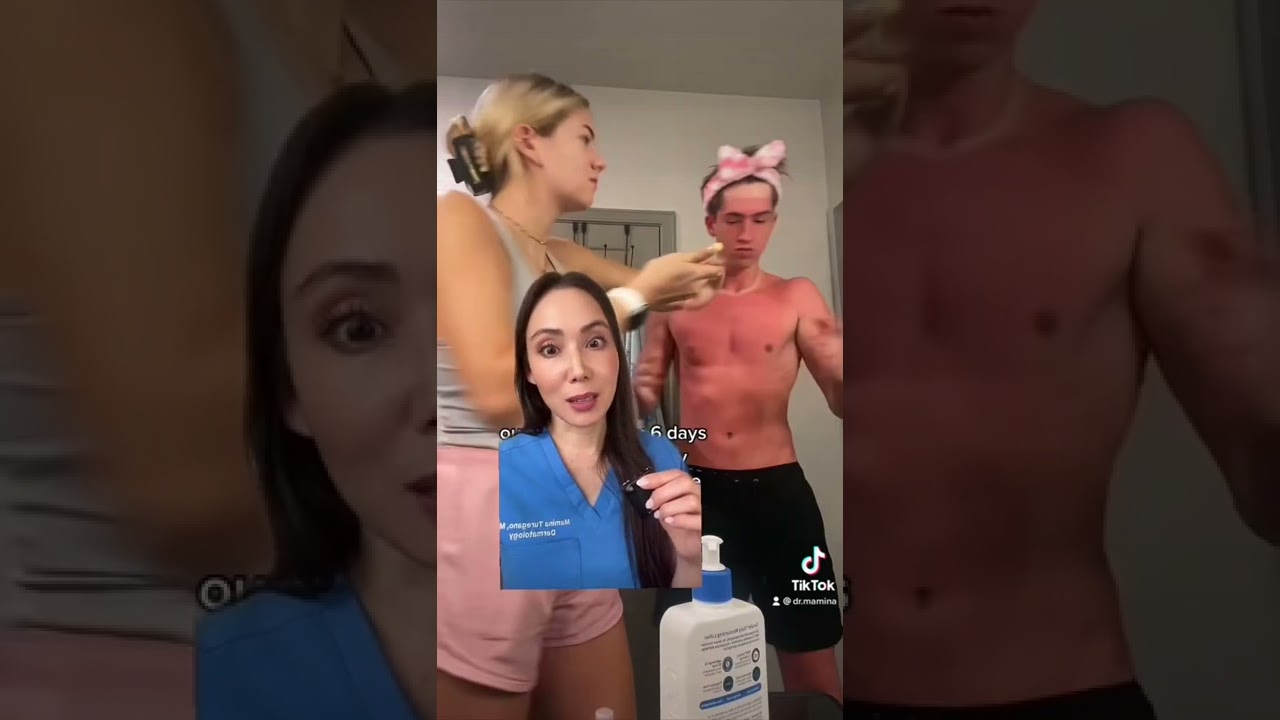 How to Heal a Sunburn