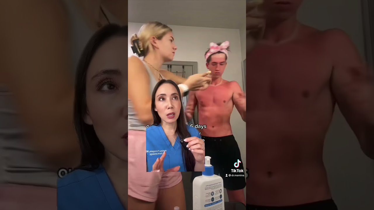 How To Heal A Sunburn