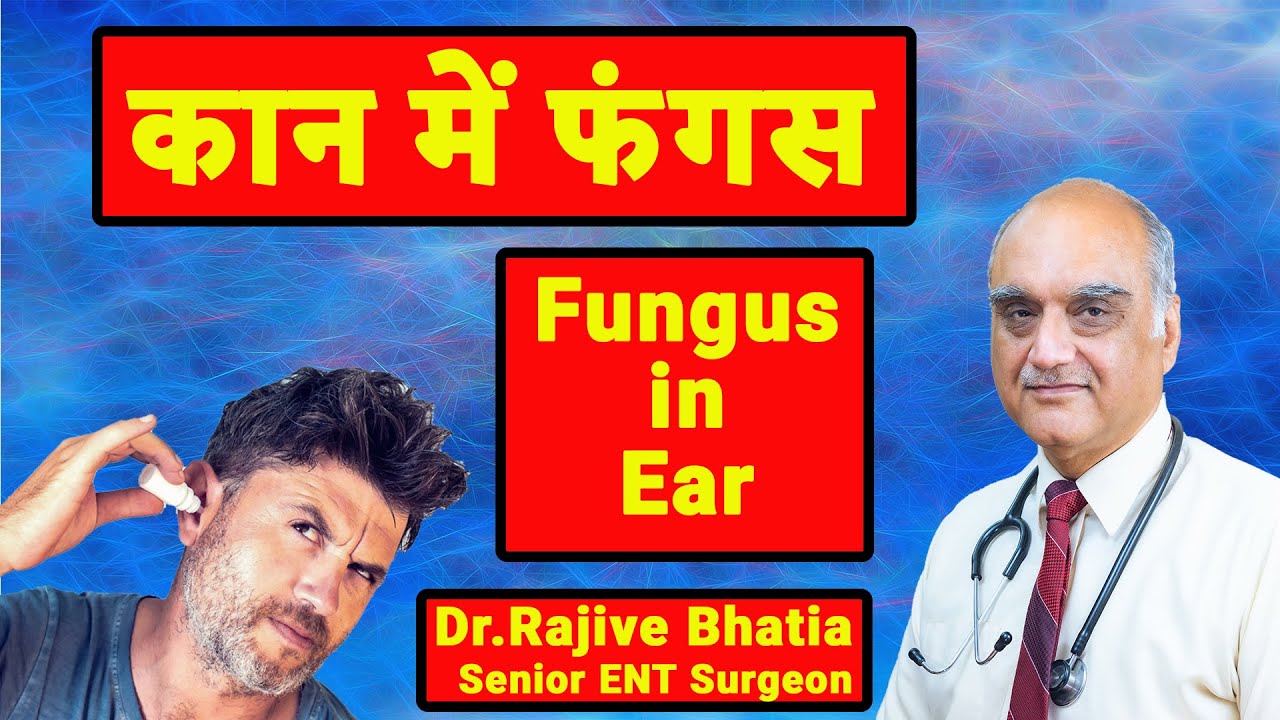 कान में फंगस। Fungal ear infection । Hindi Dr. Rajive Bhatia YouTube