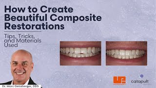 Dental Treatment: Creating Beautiful Restorations | Dec 19, 2022