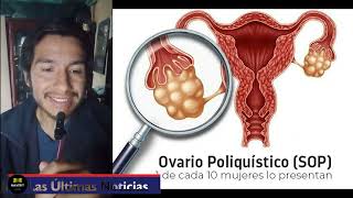 El síndrome de ovario poliquístico ya tiene nuevo nombre