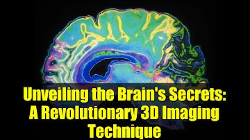 Unveiling the Brain