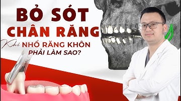 Nhổ Răng Khôn Sót Chân Răng: Nguy Hiểm Không? Cách Xử Lý Hiệu Quả Nhất Là Gì?| Nha khoa Sdental