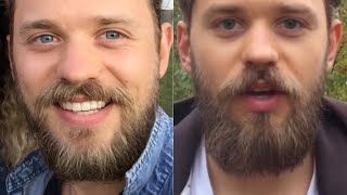 6 Tips to Fix Patchy Beard