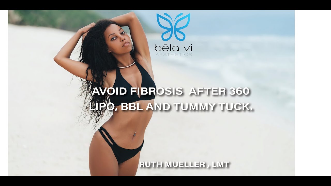 Prevention and Treatment of Fibrosis after Liposuction 