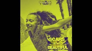 Benylis Ann - Scars To Your Beautiful