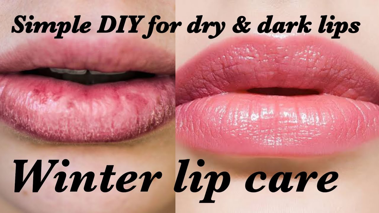 Winter Lip Care in Tamil DIY Lip Care for Dry & Dark Lips Giveaway