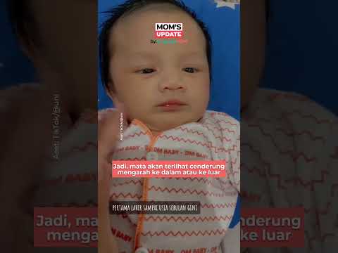 Video: Apakah bayi saya juling?