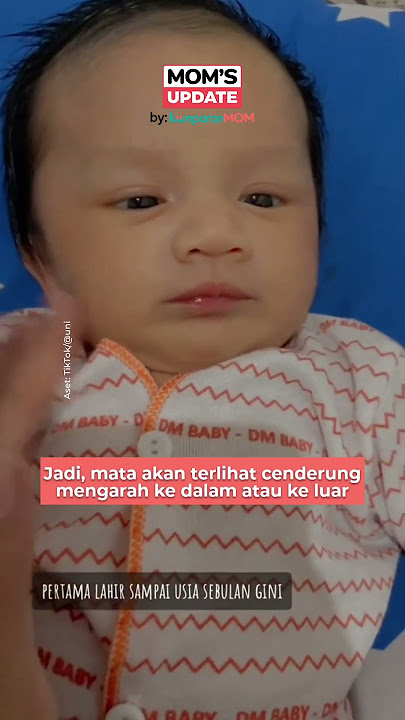 Mata Juling pada Bayi Baru Lahir, Normalkah?