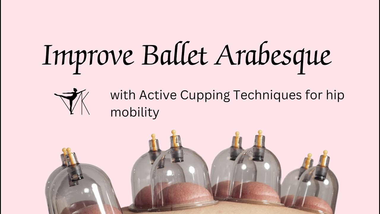 Unlocking Range of Motion for Ballet Dancers with Cupping Therapy | Ballet Injury Prevention