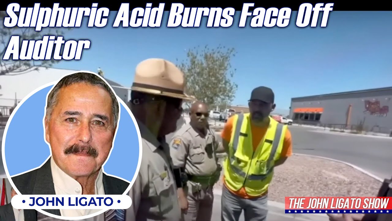 Sulphuric Acid Burns Face Off Auditor YouTube