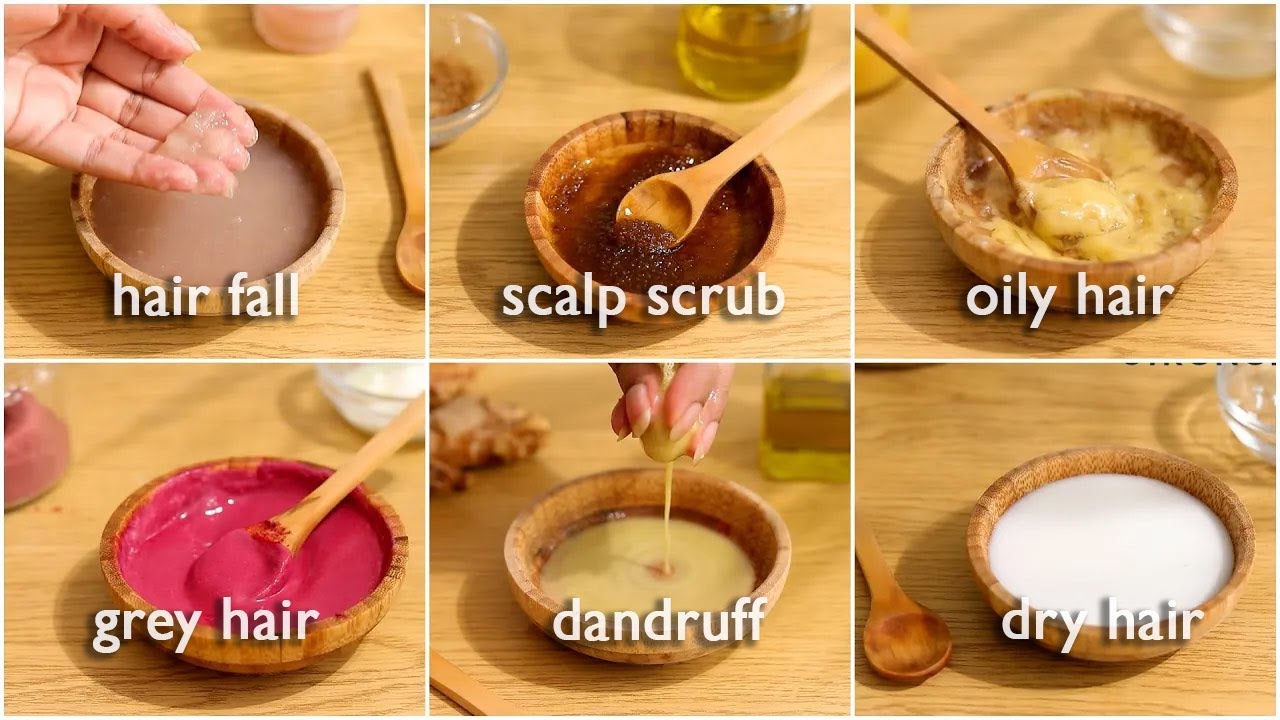 3. Anti Dandruff Combo – Dandruff free clean scalp! – Botanicalluxuriate