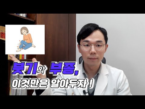 내 몸의 위험신호! 부종, 붓기의 원인과 치료법은?(위험한부종, 특발성부종)