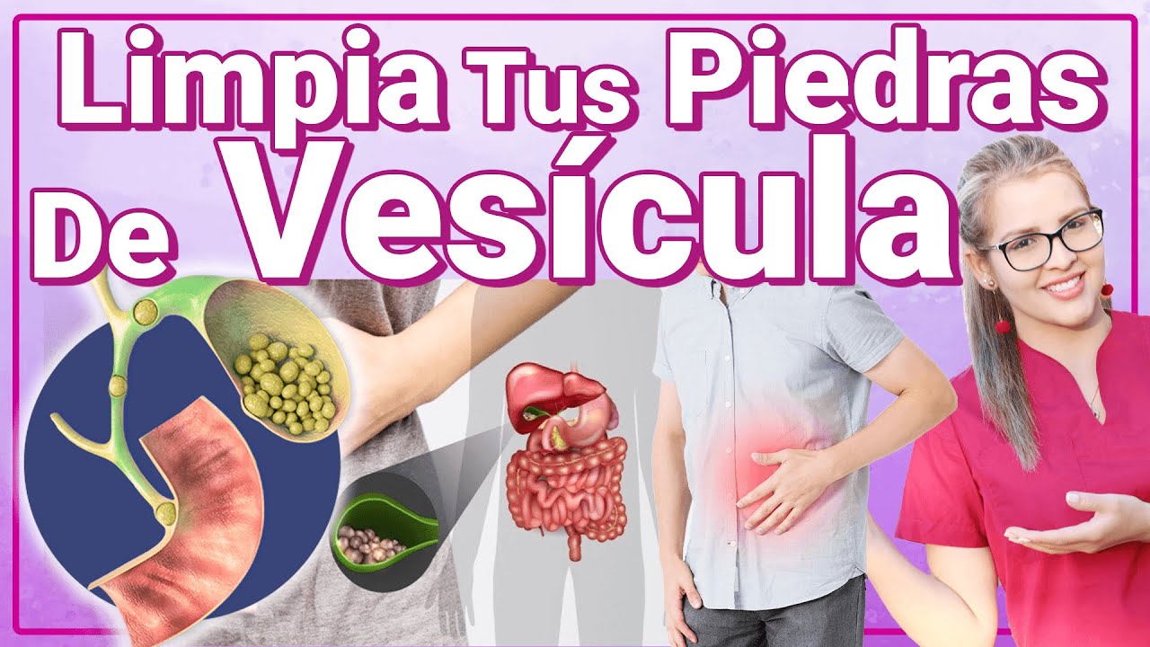 Limpia Y Rompe Piedras - Cómo Limpiar La Vesícula De Cálculos Y