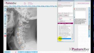 Celebrity PhraseBuilder on the PostureRay X-Ray Analysis EMR Net Worth