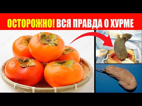 После хурмы к хирургу. СРОЧНО расскажите родным