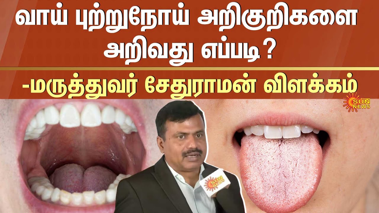 வாய் புற்றுநோய் அறிகுறிகளை அறிவது எப்படி? -மருத்துவர் சேதுராமன் விளக்கம் | Sun News