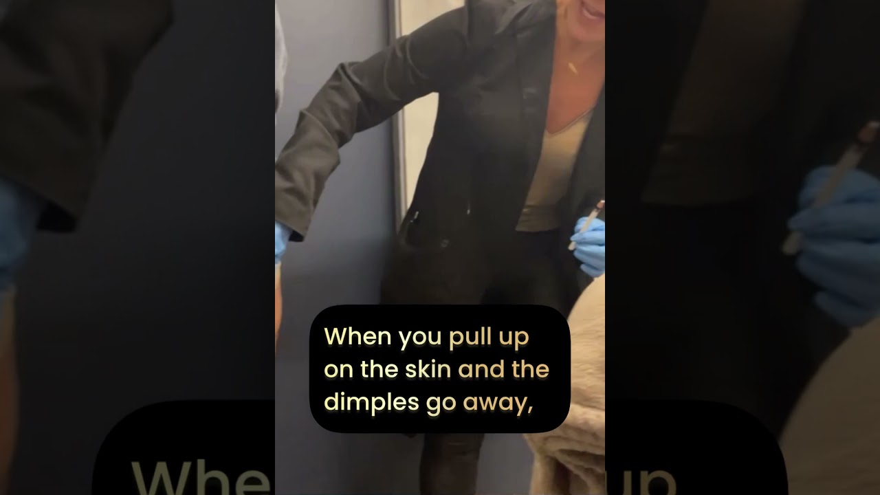 It’s Called Q-W-O, and it Treats Cellulite