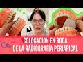 Cómo colocar las Radiografías Periapicales en boca 👄