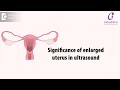 Significance Of Enlarged Or Abnormally Shaped Uterus In Ultrasound Dr Meeta Nakhare Of C9 Hospitals 