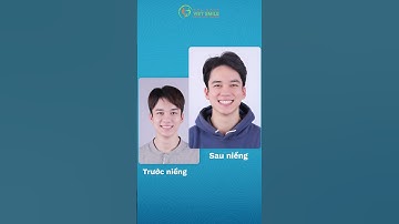 Tại sao nên chọn niềng răng invisalign? #nhakhoavietsmile #niengrang #invisalign