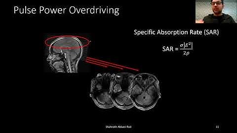 SAR reduction method for FLAIR pulse sequence at 7T (ISMRM 2020 virtual meeting)