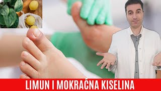 Da Li Limun Povećava Razinu Mokraćne Kiseline?