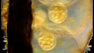Early stage snail eggs