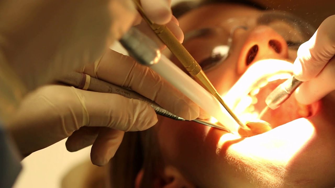 Learn How Microdentistry Can Change Your Life!