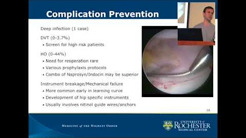 Complications and the failed hip arthroscopy, Dr. ...