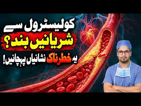 Can High Cholesterol Block Your Arteries? | Warning Signs || Dr. Ahmad Hashmi
