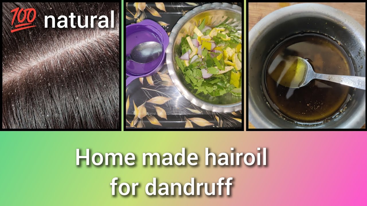 Home made hairoil for dandruff/Natural hair oil for dandruff/Remedy for
