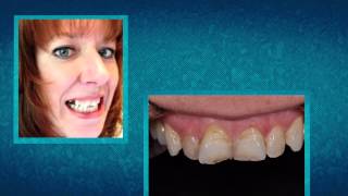 AACD Smile Story Contest: The Results