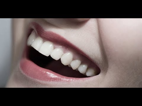 Cura recessione gengivale Roma - Studio dentistico Tabanella