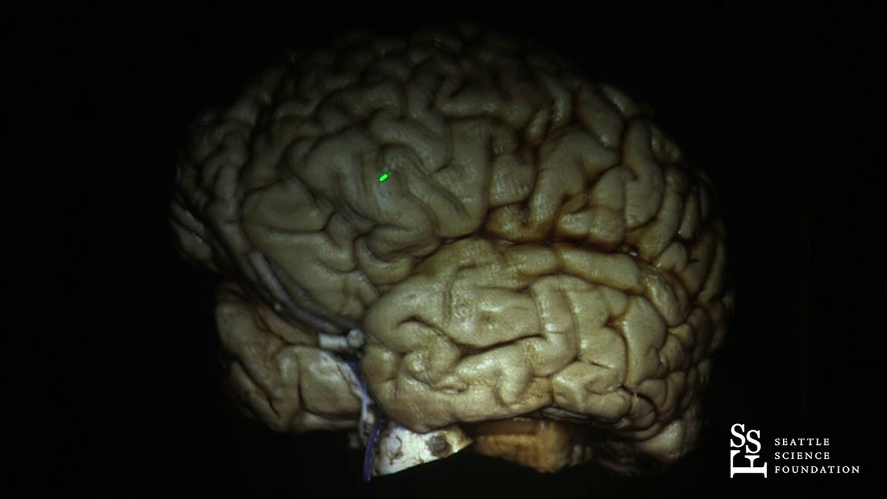 クレニアルスタディ・ガイド Tri-State Cranial 編 The Brain Surface: Sulci & Gyri - Guilherme Carvalhal Ribas, MD