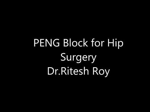 PENG BLOCK for Hip surgery