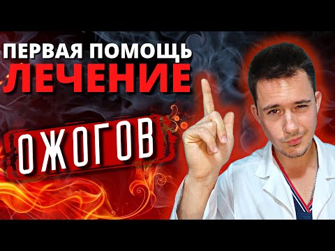 Ожоги | Первая помощь при ожогах | Лечение ожога