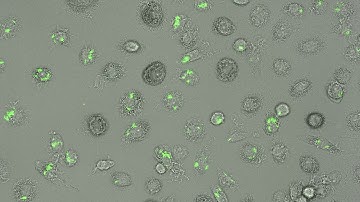 Human monocyte derived macrophages with heat killed M Tuberculosis