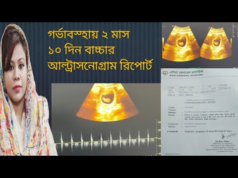 ভিডিও: কার্ডিয়াক আউটপুট নির্ধারণের 3 টি উপায়