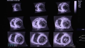 4D multi-slice imaging