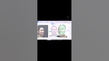 Say hello to MetiSmile - our latest addition in revolutionizing patient care. 🦷✨