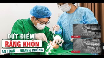 Cú sốc nhổ răng khôn 45° – KHÁCH HÀNG CHIA SẺ TRẢI NGHIỆM THẬT! 😲