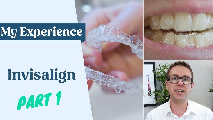 Jefferson Dental, Process of putting on Invisalign attachments!👏😁 Drop  all your Invisalign questions in comments!⤵️ #jeffersondental #invisalig