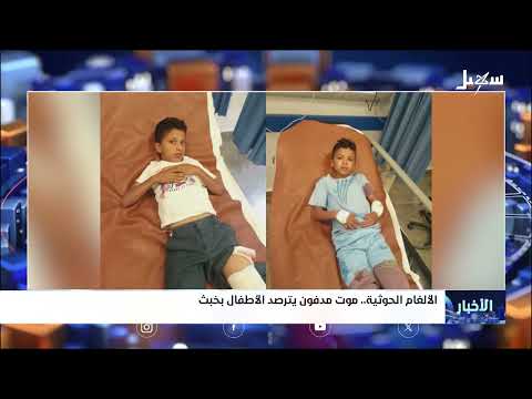 الألغام الحوثية... موت مدفون يترصد الأطفال بخبث