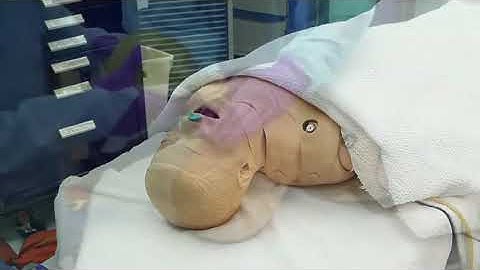 Nasopharyngeal Airway ATLS