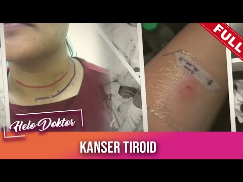 Helo Doktor (2021) | Kanser Tiroid (Sun, Sep 5)